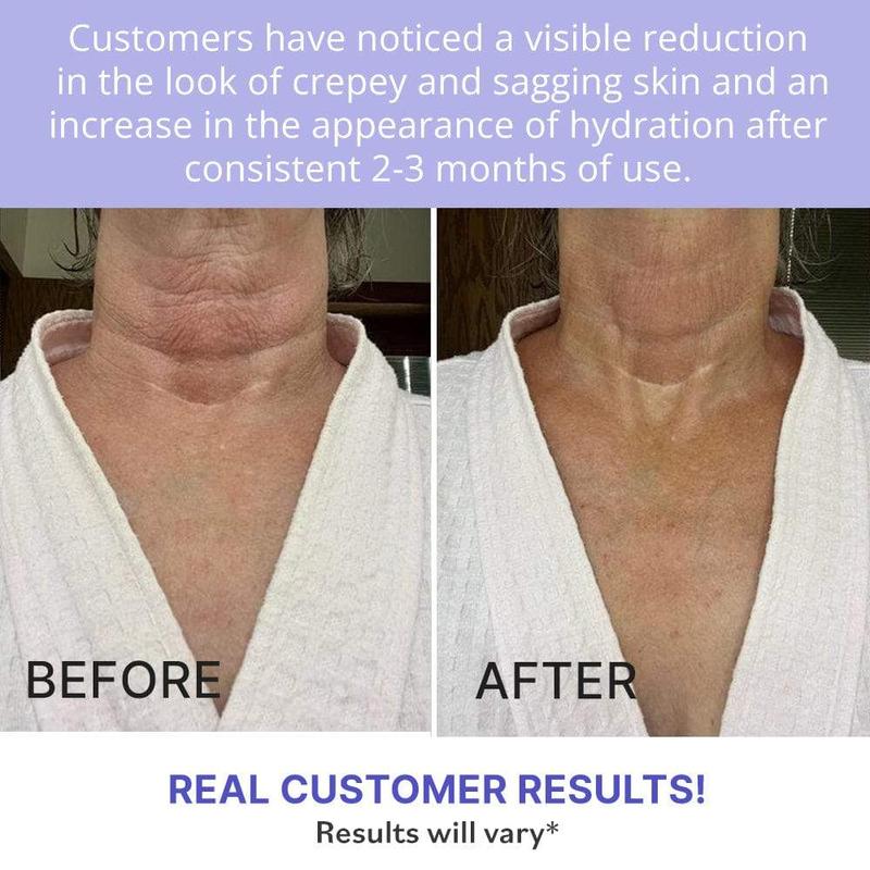 neck-and-chest-firming-cream-with-peptides-and-retinol-neck-wrinkles