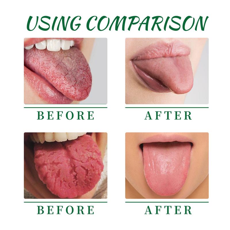 Product Introduction of EELHOE Tongue Repair Spray – Relieves Dryness, Swelling, and White Coating, Promotes Oral Health, Portable Pain Relief Spray 13